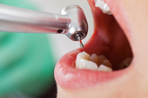 Best Urgent Tooth Repair  in Sharonville, OH